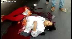 Every parents' worst nightmare - Mother holds her alive 15y.o teen split into two by an accident - New Delhi (viewer discretion advised)