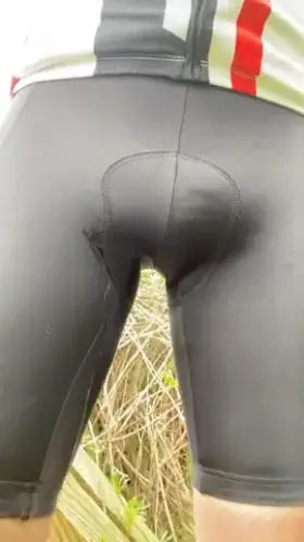 Had a little accident whilst out cycling 🙄