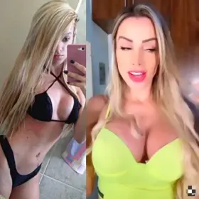 [Ts] First breast implants at 18 and third ones at 24