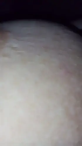 Closeup quick view as the bruising sets in from some naughty work, but the audio lets you know I'm healing ohhh so sweetly!