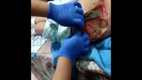 Extrem botched and gore. Like realy bad