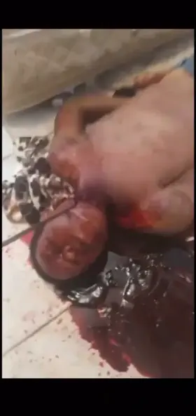 Man getting… scissored?