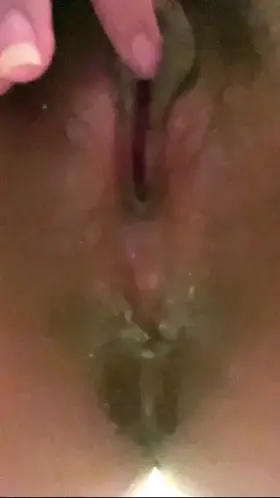 Insecure about my darken areas🥺 please give me more confident, be nice.