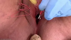 staples & estim & figging