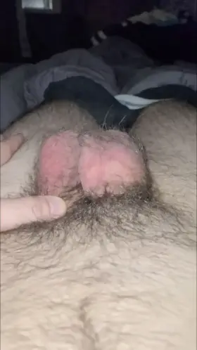 I'm cut, yet have some extra skin.