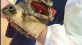 This “watch” causes me great suffering