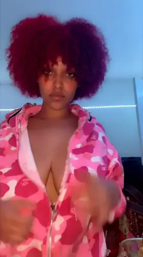 19 year old with DDD