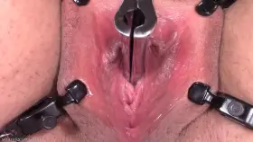 three-bladed anal speculum in my peehole