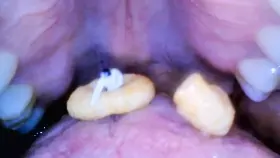 Life Inside My Mouth