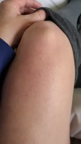 Can you get the other one with your teeth? 🤤😁