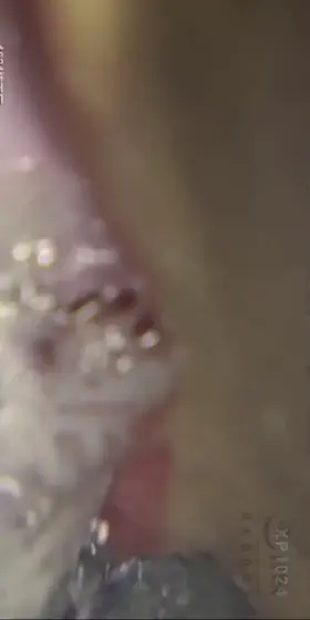 Wrecking her own throat.