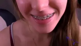 Wanting cum on braces