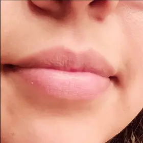 Close-up application of black cherry (OC)