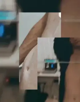 Before/after, how about