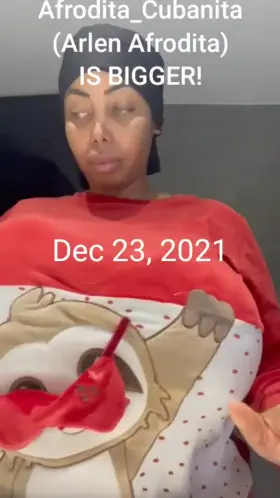 Arlen got new expanders! More than 7000cc now