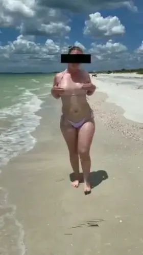 I forgot to put sunscreen on them 😩