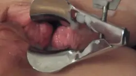 I think this will fit here