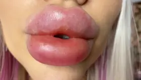 2badforyou's ENORMOUS LIPS up close!