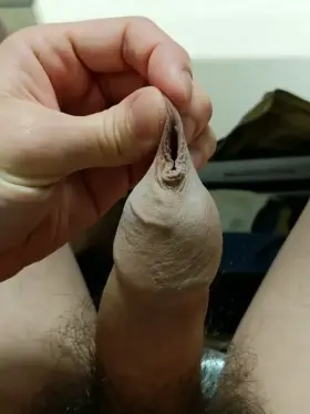 Stretchy stretchy skin skin