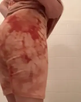 Had another gassy day ! [listen on red gifs ]