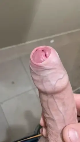 Who loves a foreskin peel?