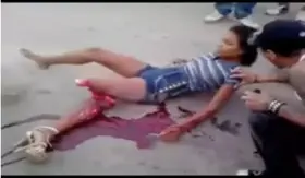 (Nsfw) The state of the girl's leg after a traffic accident (Crime scene is unknown)