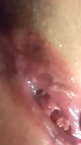 When you go to the bathroom and it’s still seeping out 😲