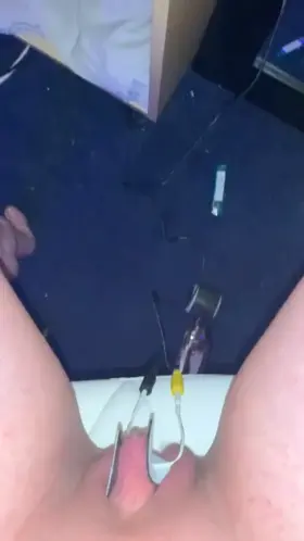 Clit electroshocked [F]