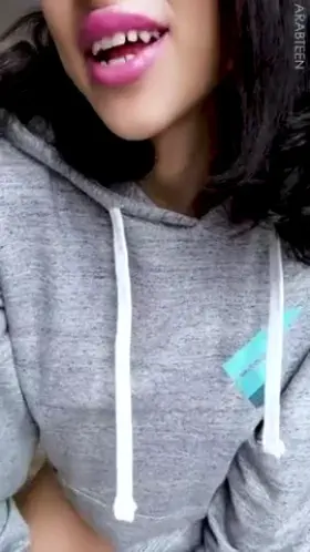 Am I Hiding Them Well?🙈