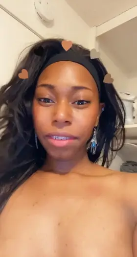 If you look closely you can see my new color bands, unless your looking at my salvia drip down 💞☺️