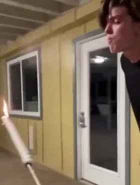 HMFT after kid tries to be a fire breather...