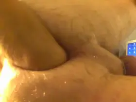 My gape with prolapse