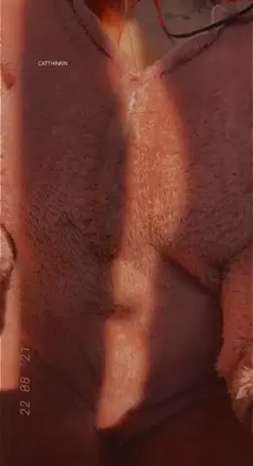 My veins look so pretty in the sun