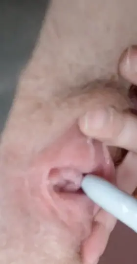 Sharpie In My Urethra 😈