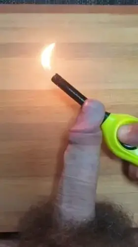 Hey, Doc, sometimes it burns a little... (OC)