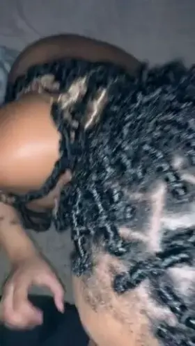 rxploded all over her face .