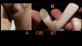 A or B