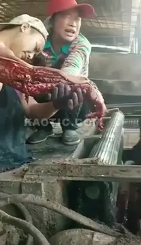 She accidentally got her hand stuck in the machine