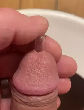 This hole was needing attention.