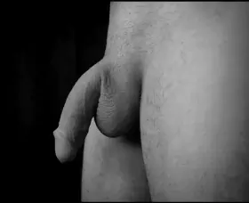 Medium to small flaccid.