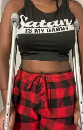 Not even a broken leg can stop me from showing all of reddit my tits :P