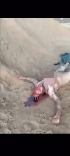 Scalped Corpse Found In Brazil