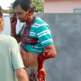 Man with severe injuries tries to make a phone call