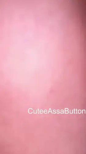 Freak in the street.. literally [f]