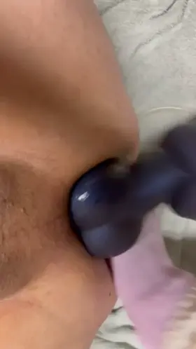 Large Chance Flared with large Rex DP