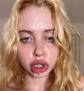 Left her face a mess