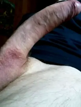 Throbbing with head semi-exposed