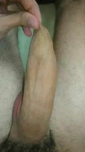 Focus on the foreskin