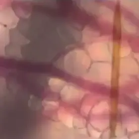 A Mosquito's proboscis searching for a good vein to tap into.