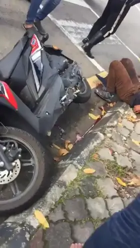 A woman whose face was torn after the accident